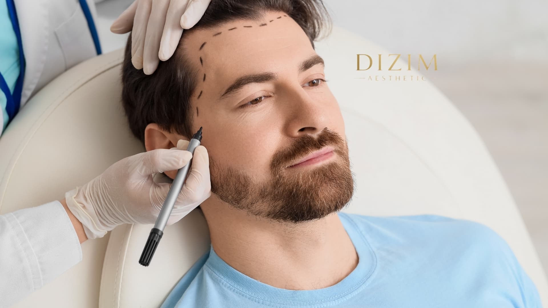 Haartransplantation in Düsseldorf: Methoden, Heilung und Planung