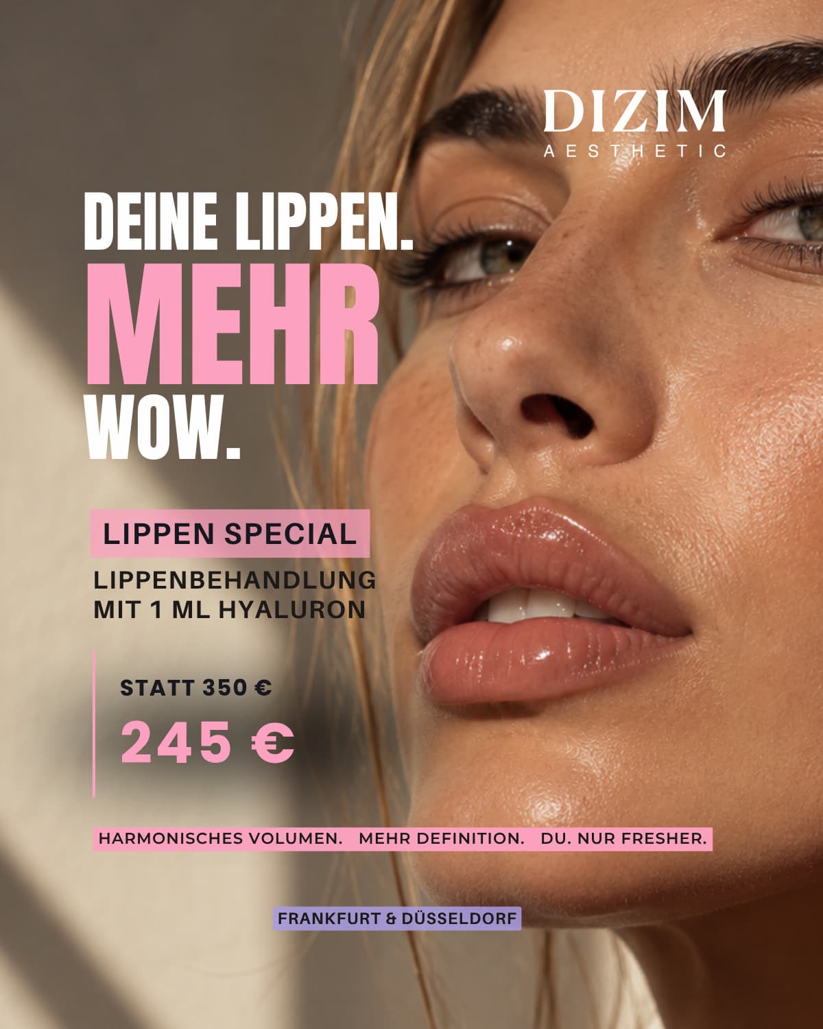 Lip Special bei Dizim Aesthetic - Lippen 1 ml Hyaluron jetzt 290 € statt 350 €
